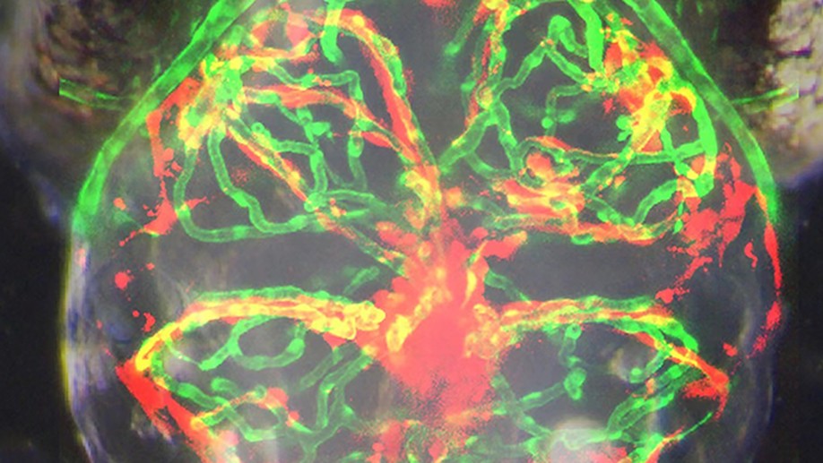 Clinically relevant orthotopic xenograft models of patient-derived glioblastoma in zebrafish