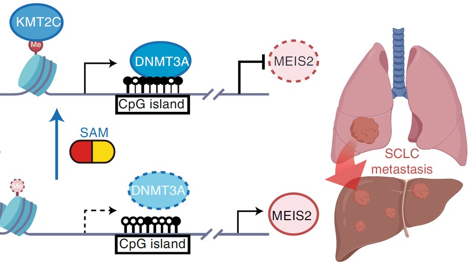 KMT2C deficiency promotes small cell lung cancer metastasis through DNMT3A-mediated epigenetic reprogramming